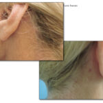 Thumbnail of