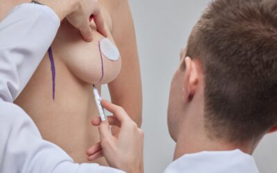 Mommy Makeover Magic: Body Surgery Options for New Moms at Napa Solano Plastic Surgery