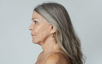 Natural Facelift Results: Why Modern Techniques Deliver Better Outcomes