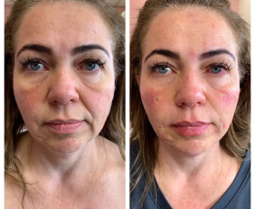 Dr. Tran - Injectables